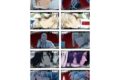 BLEACH 千年血戦篇 クリアカードコレクション 【1BOX】 キャラアニで
                                                2025年12月発売